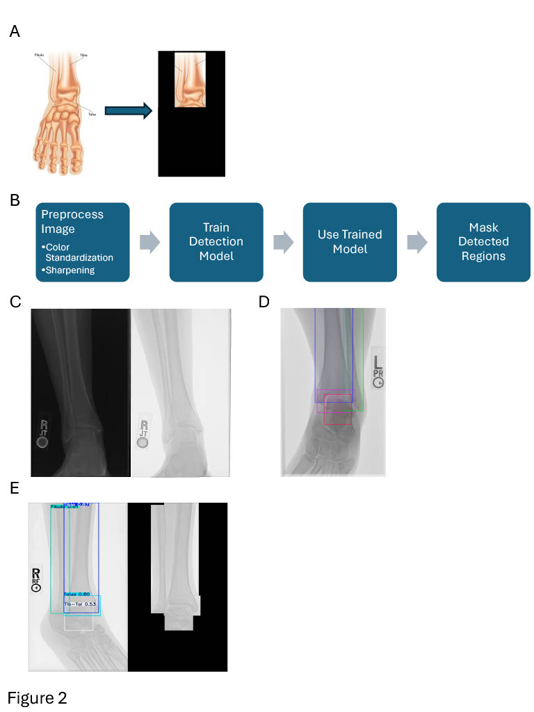 Pipeline for detecting ankle bones in X-rays, with detection boxes on example images